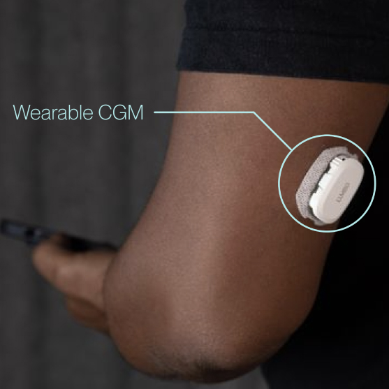 Sensor on arm