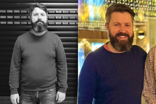 Daithi before and after
